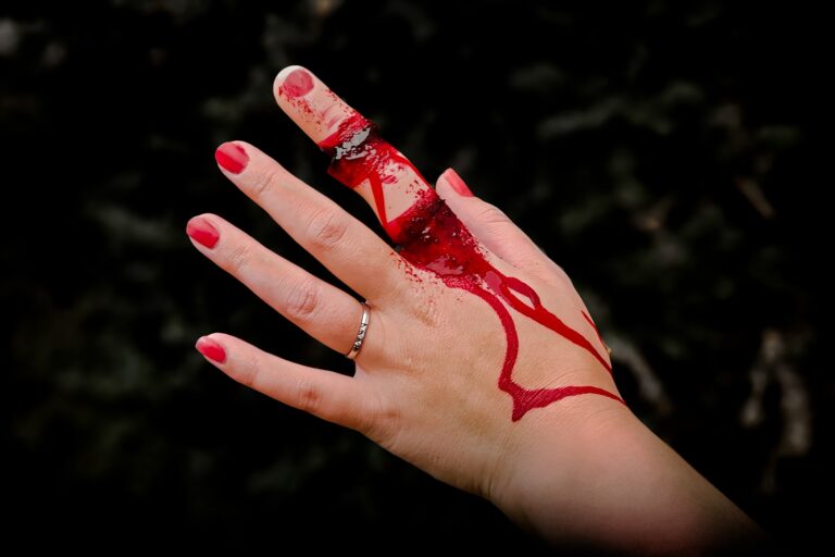 Zoelibat Bleeding Sliced Finger-35837